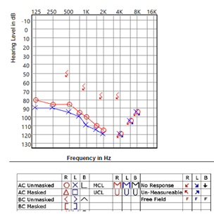 Image of audiogram